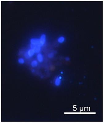 Enterocytozoon Bieneusi Infects Children With Inflammatory Bowel Disease Undergoing Immunosuppressive Treatment